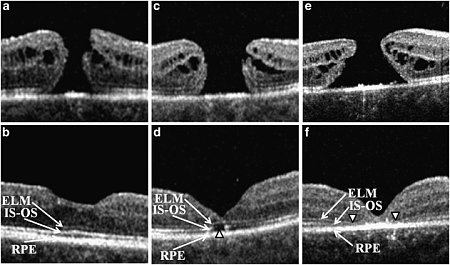 Clicca sull'immagine per ingrandirla

Nome:   eye2011237f1.jpg
Visite: 157
Dimensione:   130.1 KB
ID: 15978